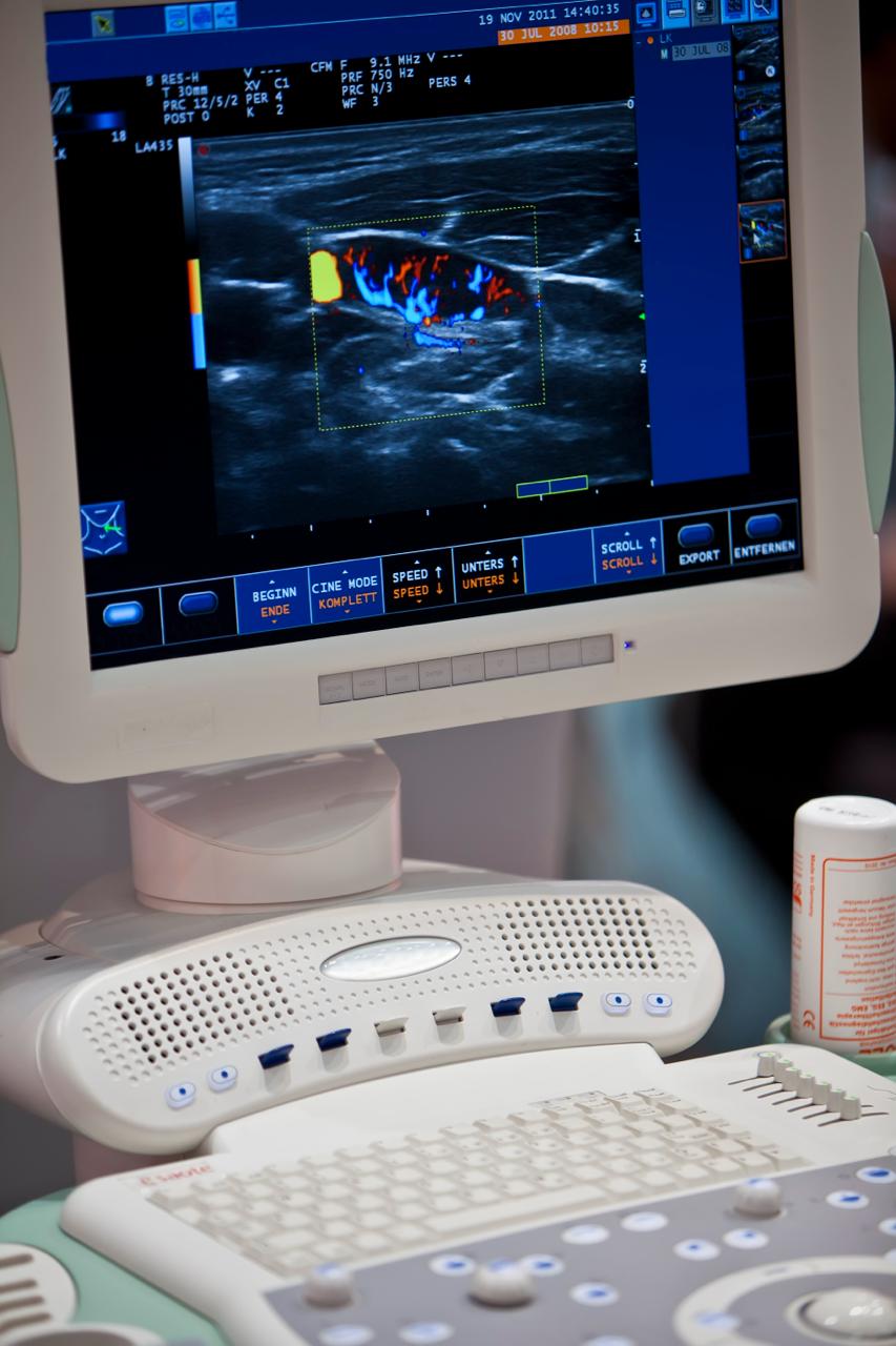 Echocardiography (2D Echo)