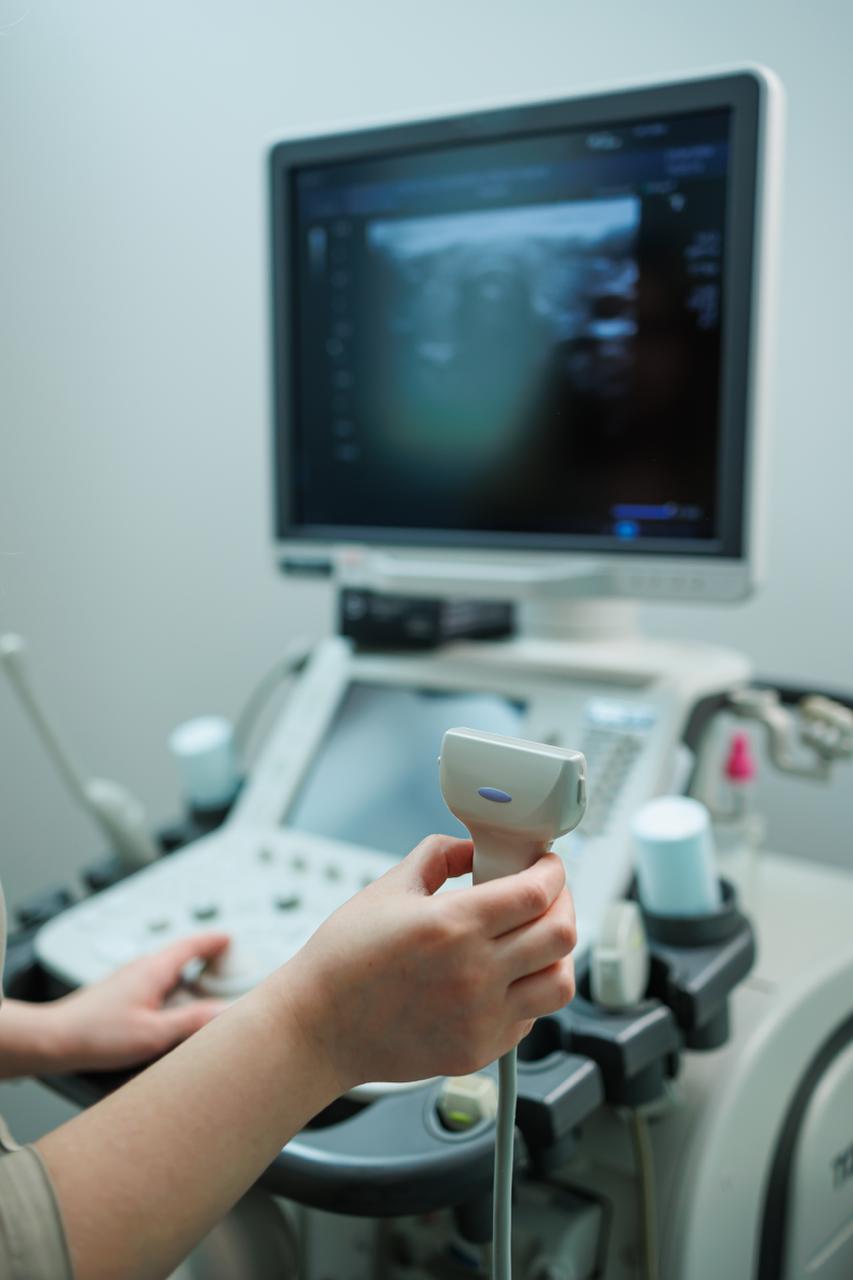 Upper Extremity Arterial Ultrasound (UEA)