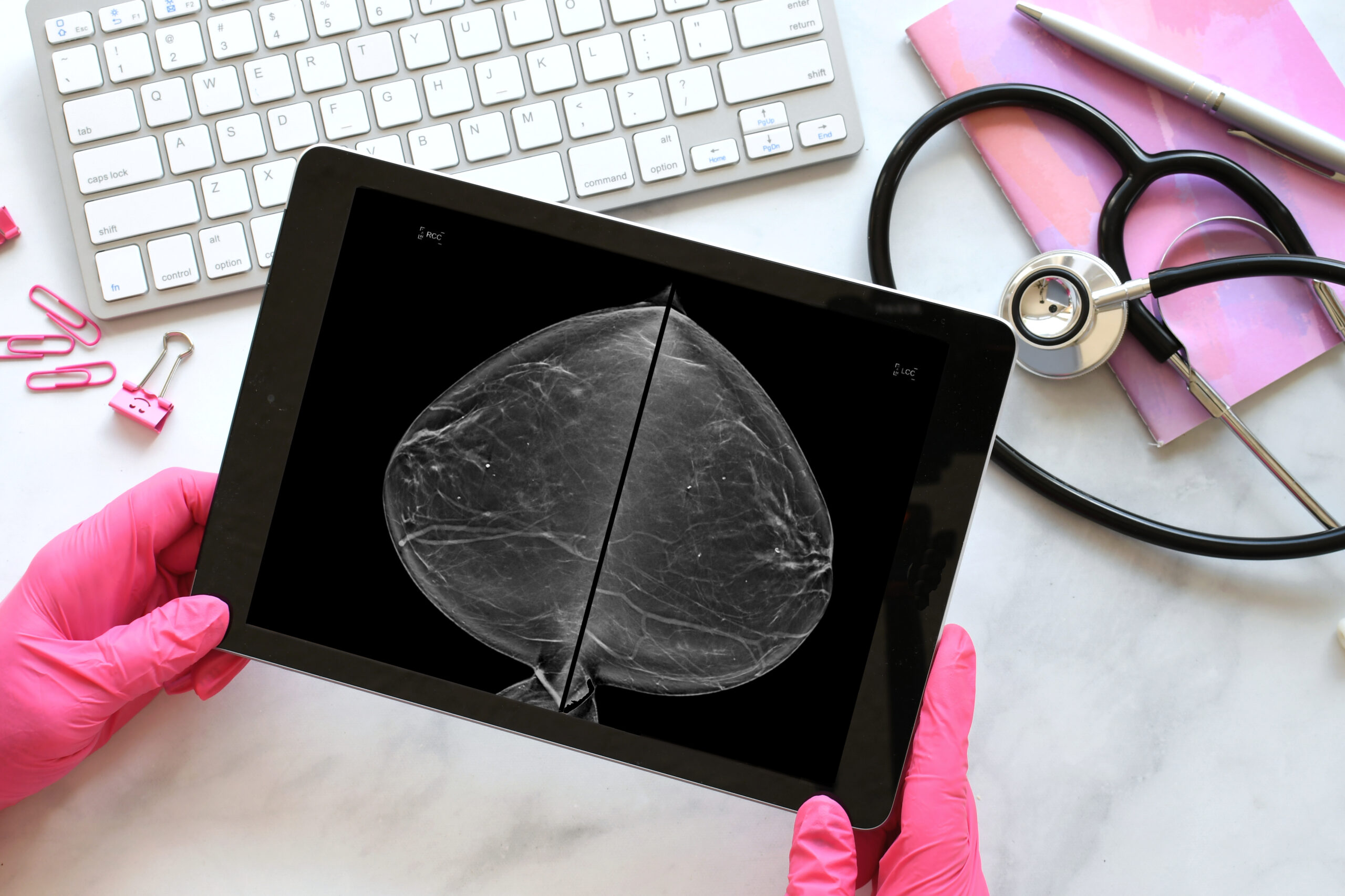 Mammogram images showing dense breast tissue on a tablet