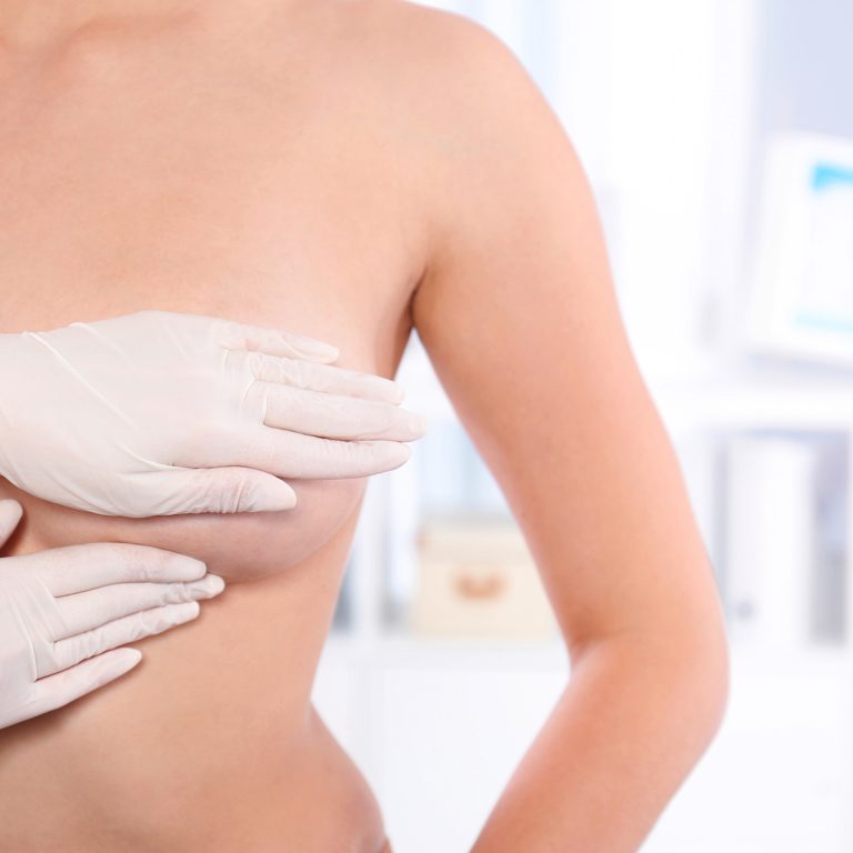 Doctor checking woman's breast at hospital, closeup